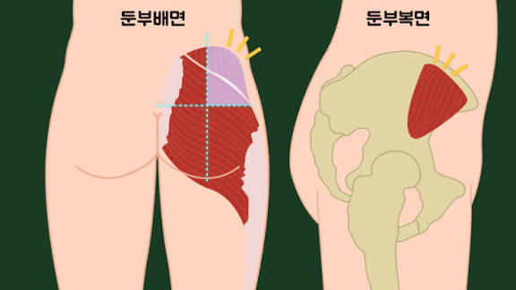 인젝 입문 문의드립니다