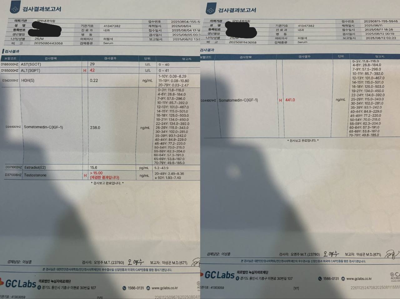 ㅅㅈㅎㄹㅁ 피검사 결.과.지